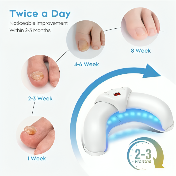 NailRenew™ | Nagelpilz bekämpfen und beseitigen!