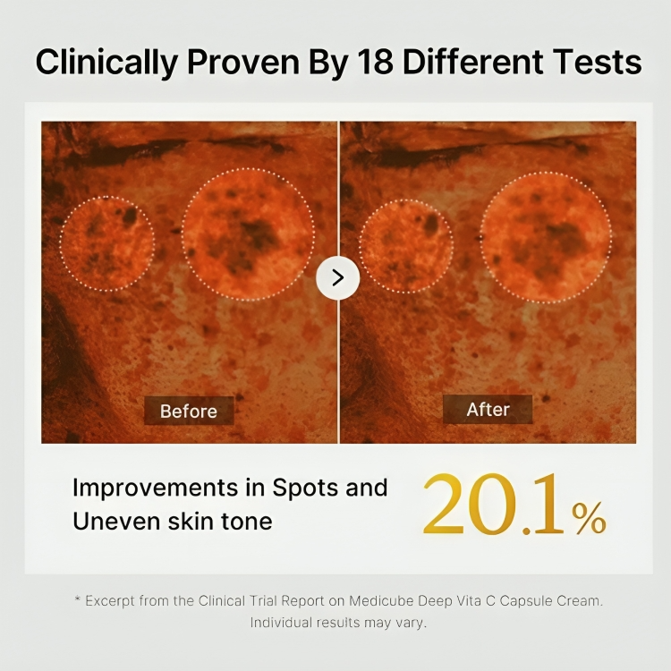 1+1 GRATIS | VitaCream™ Vitamin-C-Kapsel-Creme