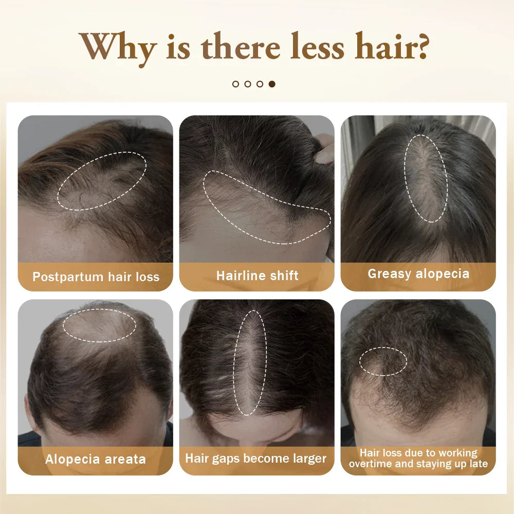 Wochsy - Natürliches Haarwuchsöl | 1 + 1 GRATIS