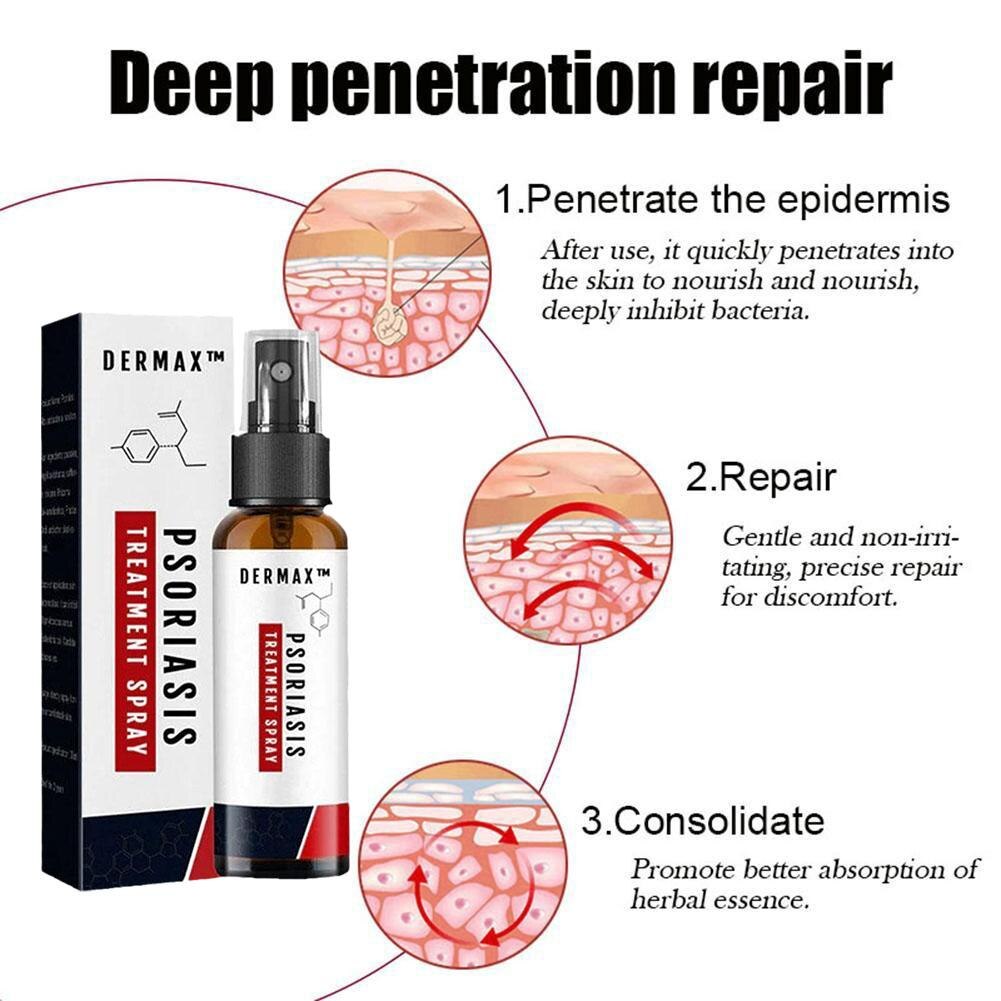 Dermax™ Schuppenflechte-Spray