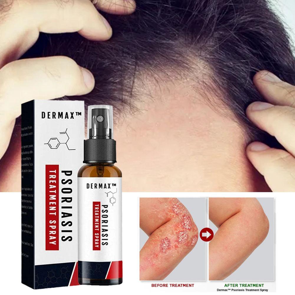 Dermax™ Schuppenflechte-Spray