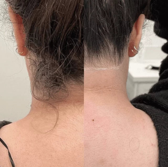 Effektiver Haarentfernungsschaum