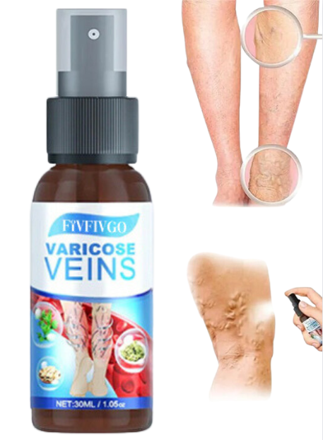 Krampfader-Spray (1 + 1 KOSTENLOS)