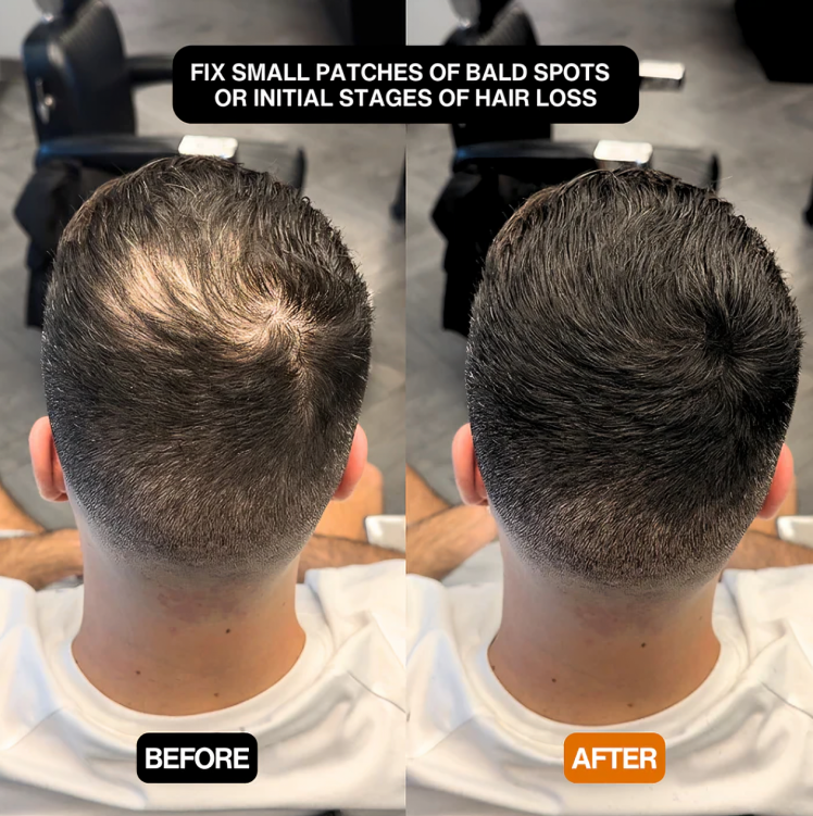 CoverEdge™ | Eine schnelle Lösung für einen natürlichen, voluminösen Haaransatz!