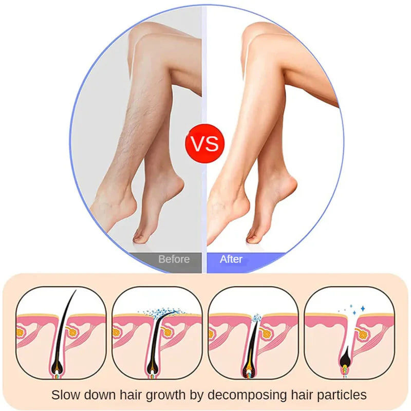 SilkTouch - Haarentfernung | 50% RABATT