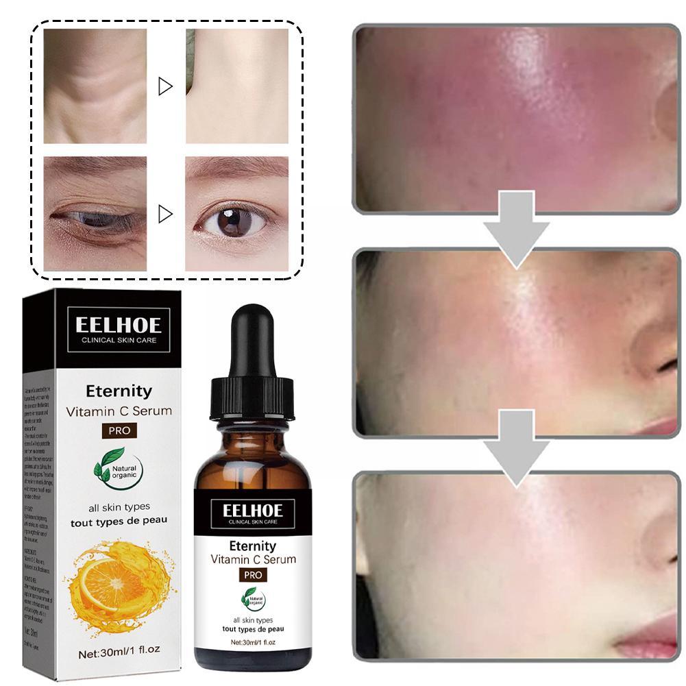 EELHOE™️ Dark Spot Corrector Gesichtsserum