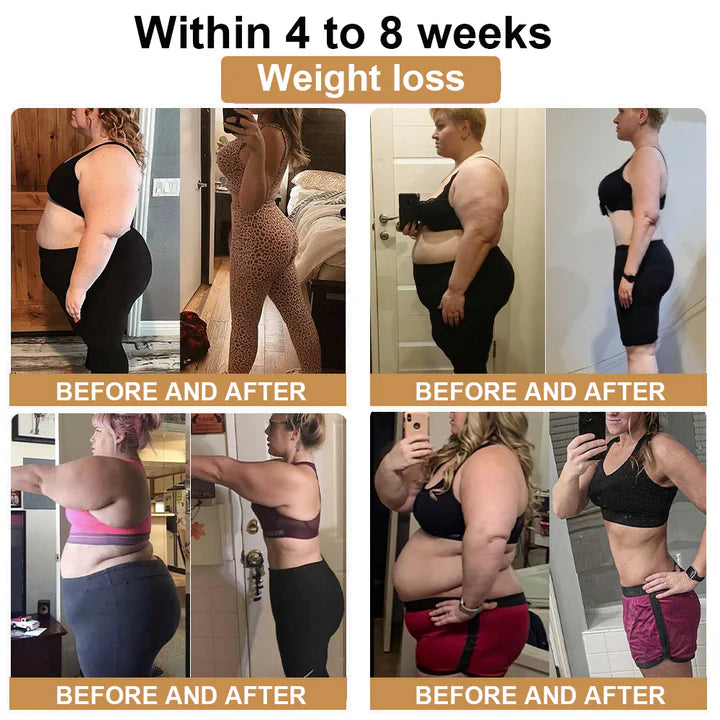 Fettverbrennungspflaster | Mit Bienengift & Kräuterextrakten | Stoffwechsel aktivierend | Natürlich & Effektiv (10er Set)