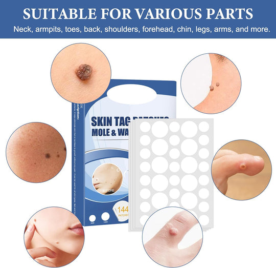 TagAway Hautanhängsel Entferner Pflaster | Schmerzfreie & Narbenfreie Lösung | Natürliche Formel