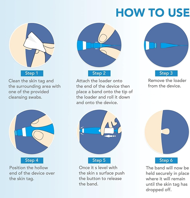 TagErase™ | Entfernen Sie Hautanhängsel schnell und sicher!