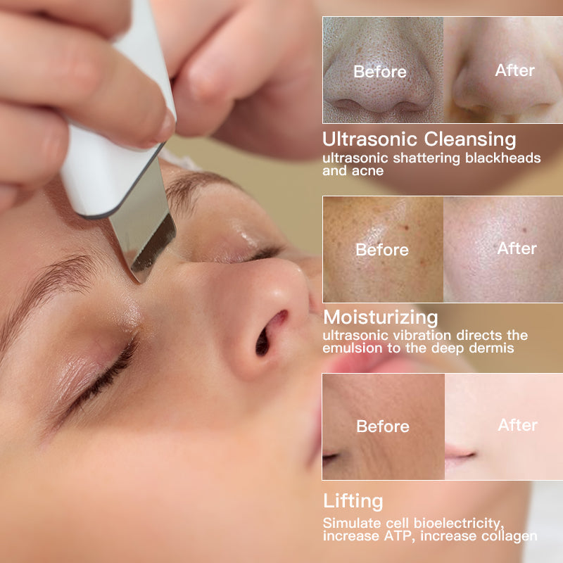 SkinRelief™ - Effektive Hautstraffung