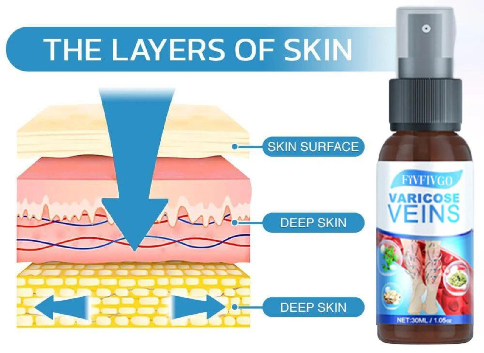 Krampfader-Spray (1 + 1 KOSTENLOS)