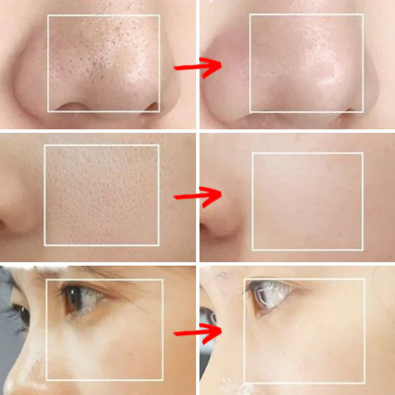 PoreCleaner™ | Für sichtbar reinere Haut in nur wenigen Minuten!