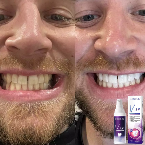 V34-CleanTeeth™- Farbkorrigierende Zahnpasta!