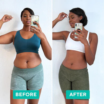 BodySculpt Pro | Schlankheits-Massagegerät | Fettverbrennung & Hautstraffung