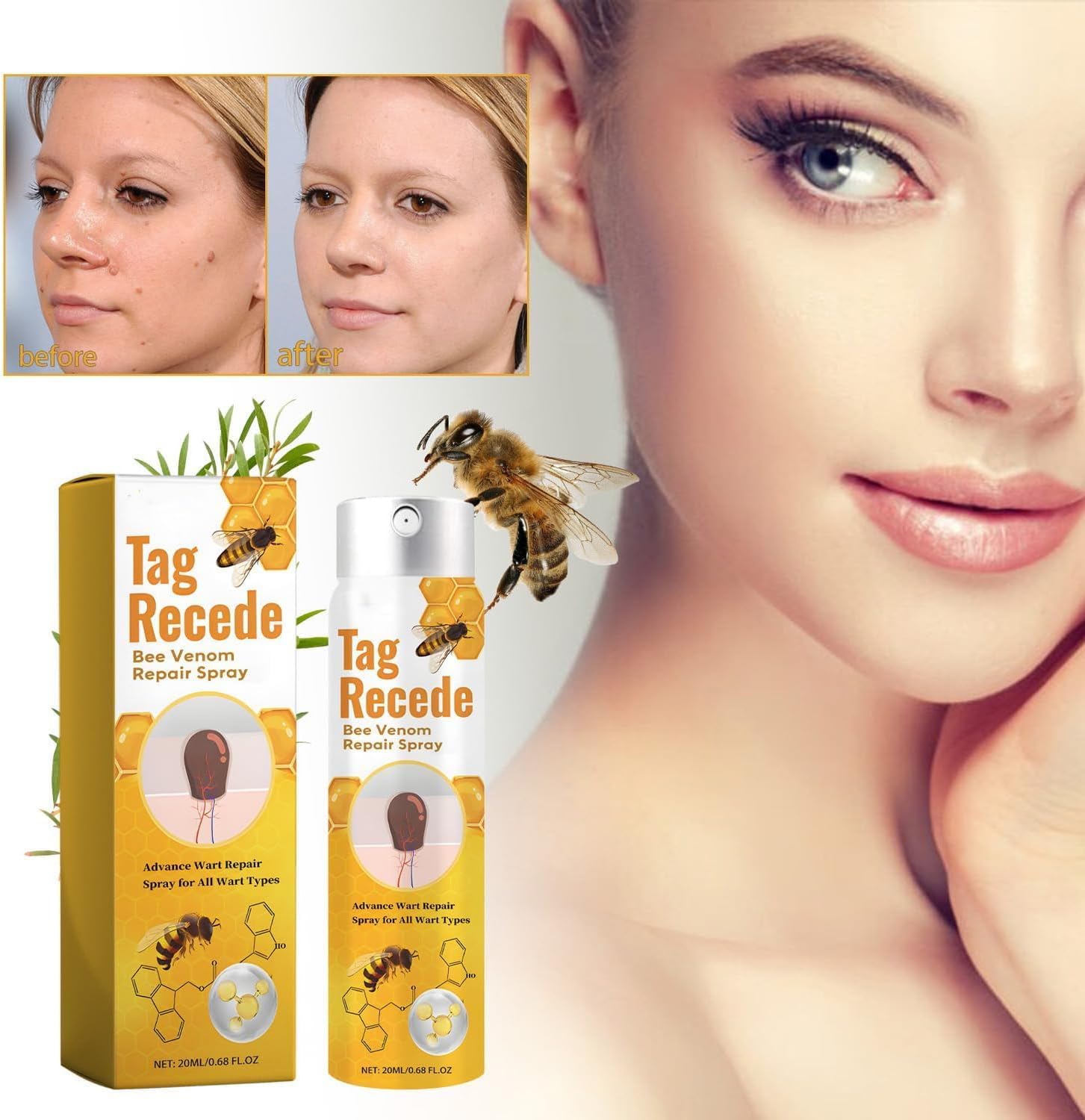 Warzen Entferner | Bienengift Formel | Effektiv & Schonend | TagAway | 1+1 Gratis