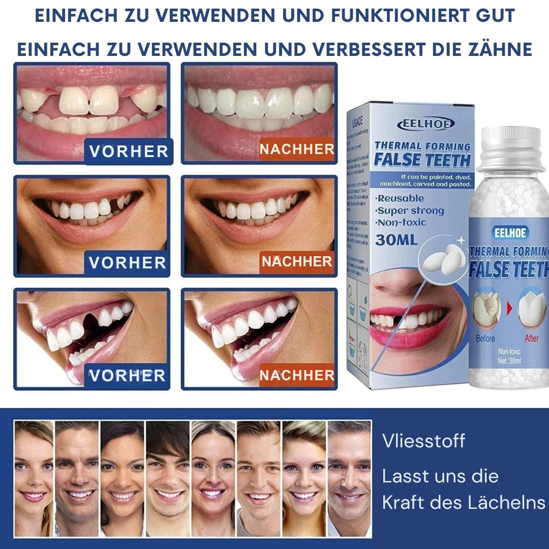 Zahnreparatur Set | Sofort Zahnlücken Füllen | Natürliche Zahnfarbe | ToothPerfect