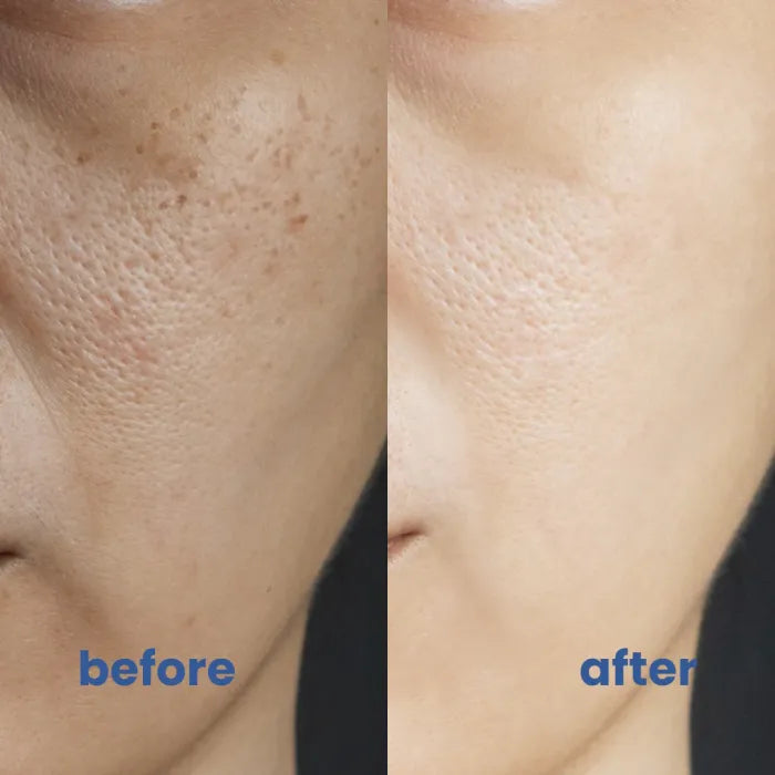 1+1 Gratis | Color Correcting CC Cream™ — Beruhigende, Perfekte Haut, die den ganzen Tag strahlt