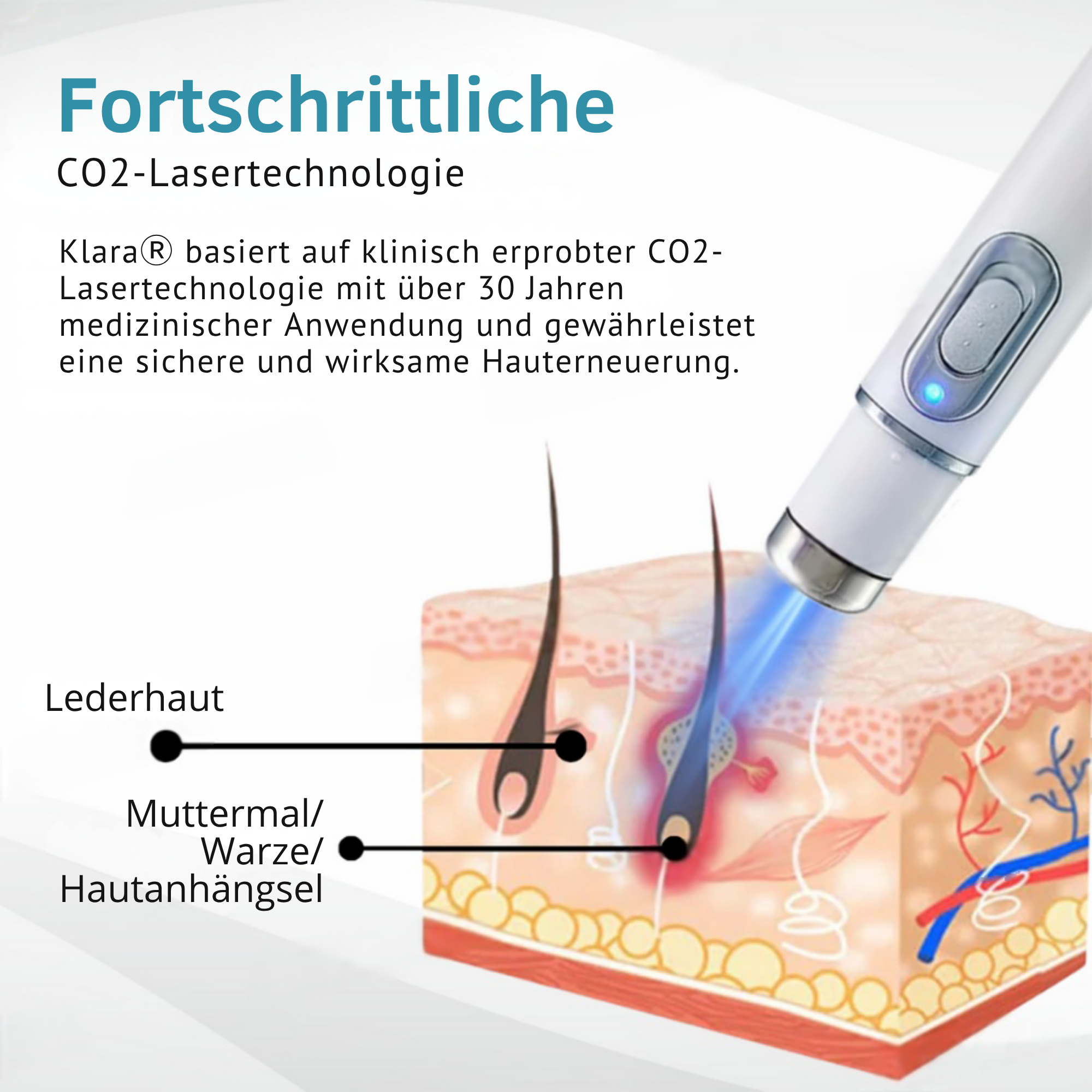 Klara™ Schmerzfreier Laser-Stift — Enthülle jederzeit makellose Haut und Selbstvertrauen