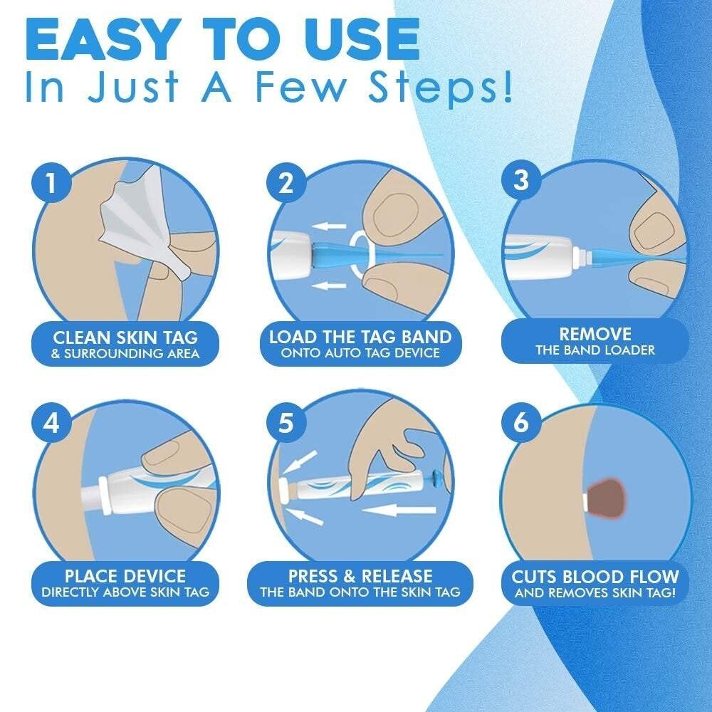 TagGone™ - Schnelles Auto-Tag-Entfernungskit