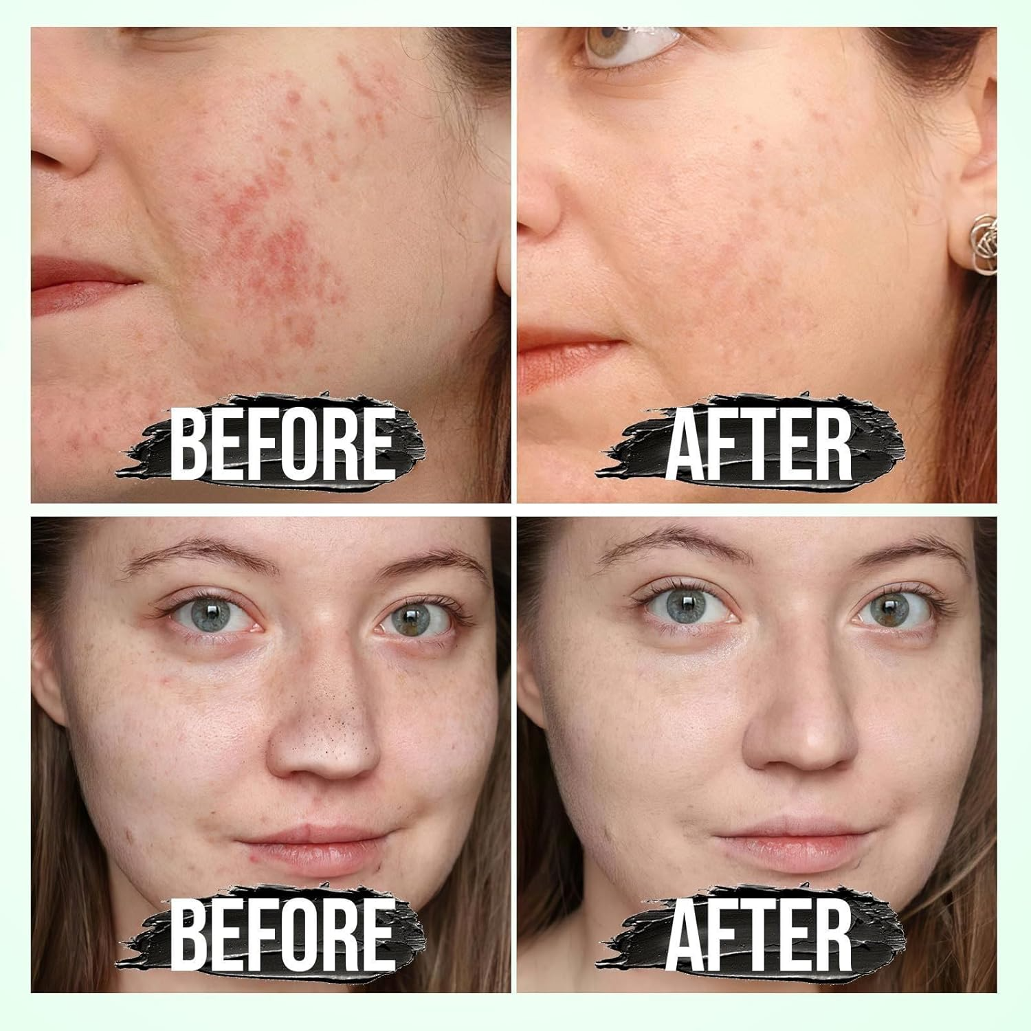 PureGlow 50ML - Mitesser entfernende Gesichtsmaske | 1+1 GRATIS