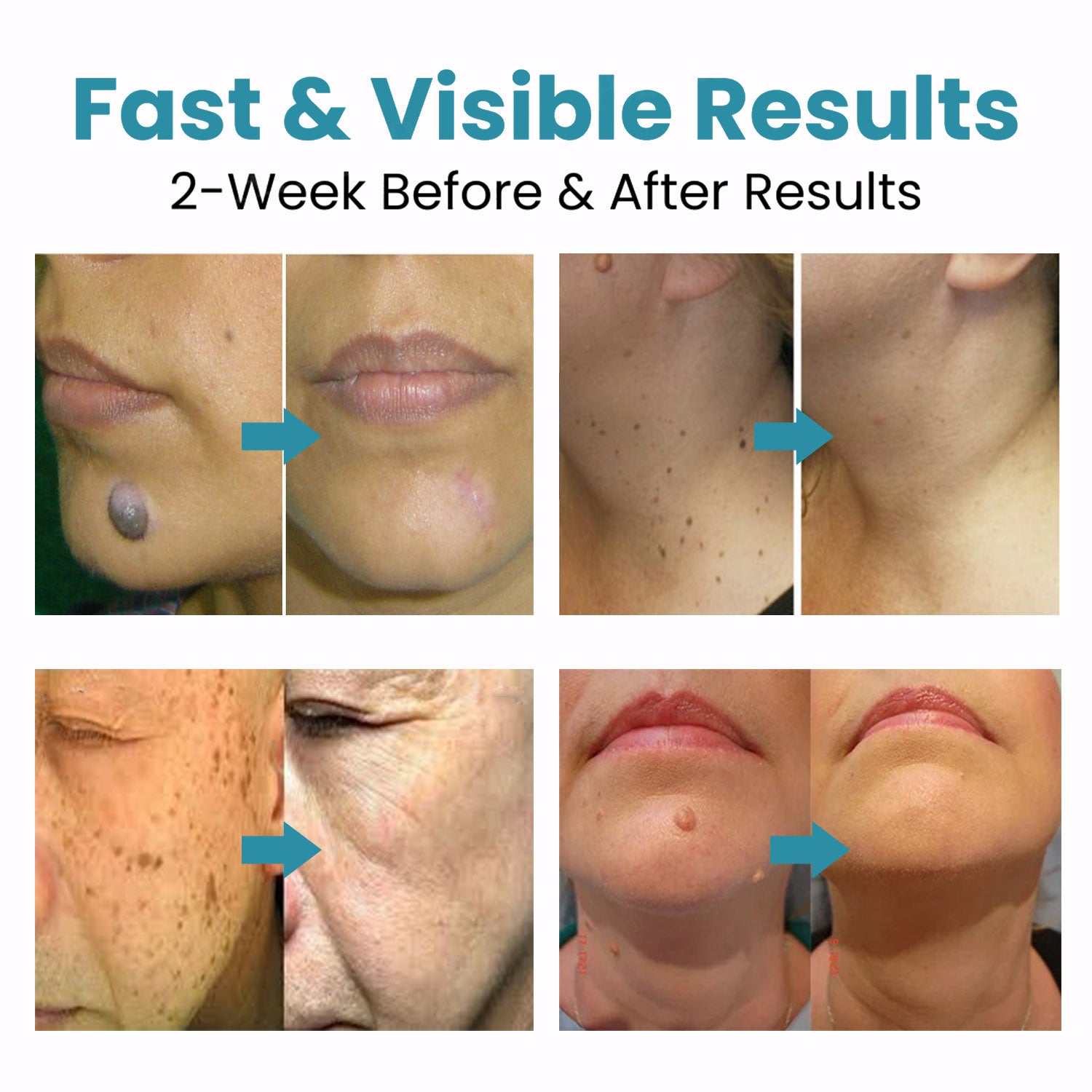 LumaClear™ — Enthülle makellose, strahlende Haut, die du gerne zeigen wirst