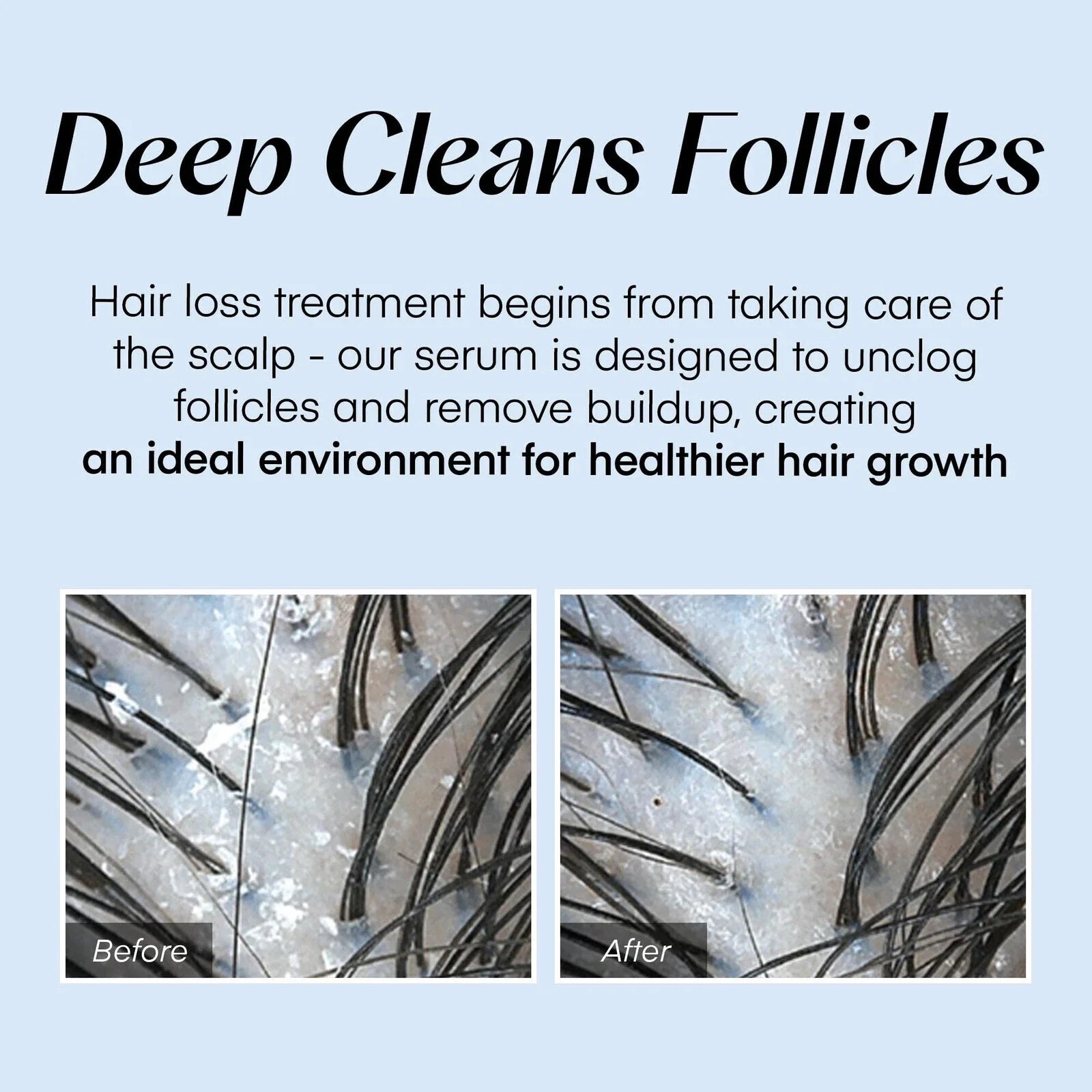 VibraRoot™ Serum – Beleben Sie frisches, dichtes Haar und beruhigen Sie Ihre Kopfhaut den ganzen Tag lang