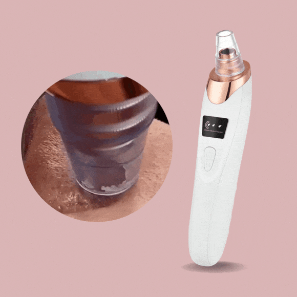 SkinSpa™ Mitesser-Entferner