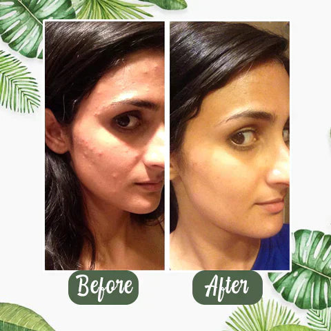 1+1 GRATIS | Poreless Deep Cleanse Mask Stick™ — Enthülle frische, strahlende Haut ohne Mitesser und Glanz