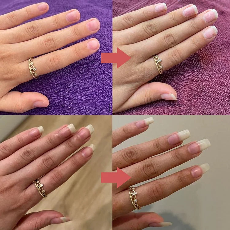 NagelGlanz | Nährendes Nagelöl für gesunde & starke Nägel