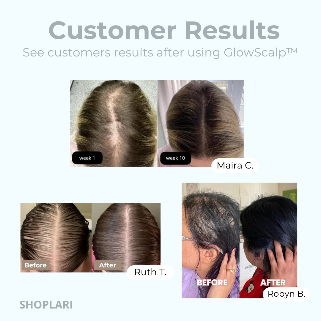 GlowScalp™ Kopf-Massagebürste