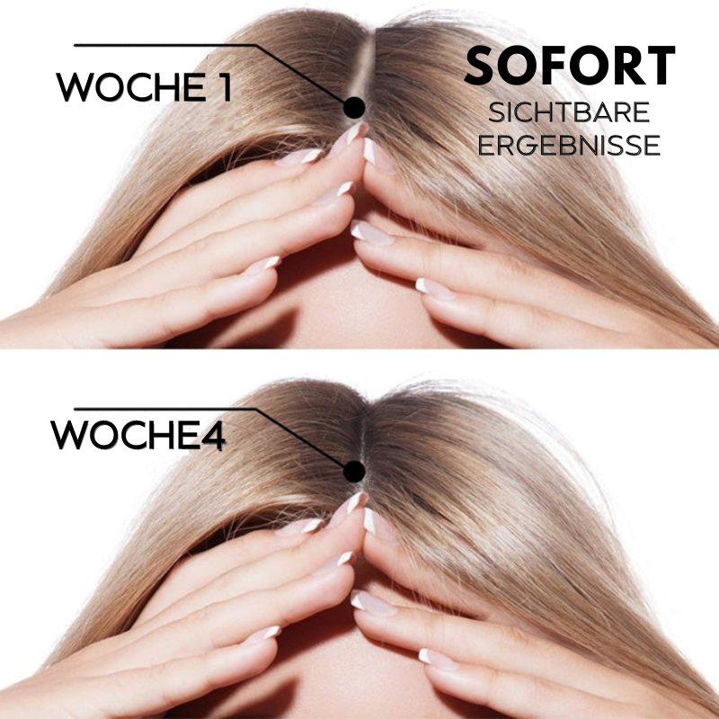 1+1 GRATIS | HairRegrow™ | Haarwachstumsspray