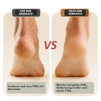 Elektrischer hornhautentferner für glatte Füße