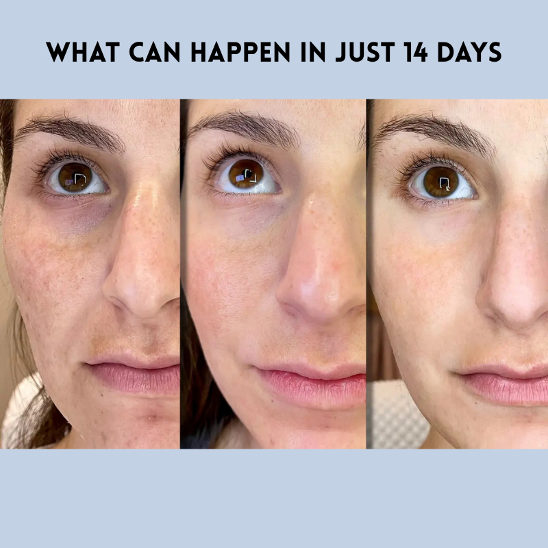 1 + 1 GRATIS HEUTE | ReStrip™