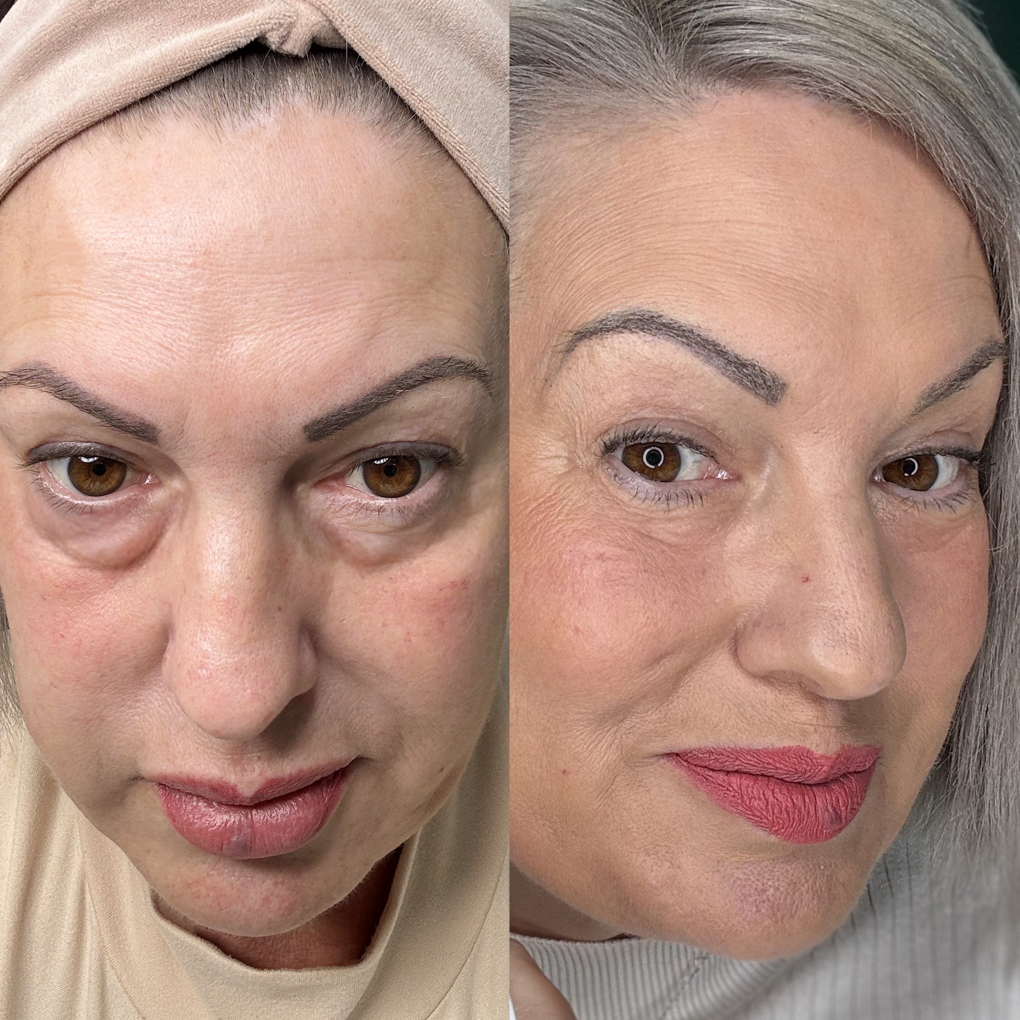 EyeRevive™ | Verabschieden Sie sich von Augenringen und Schwellungen!