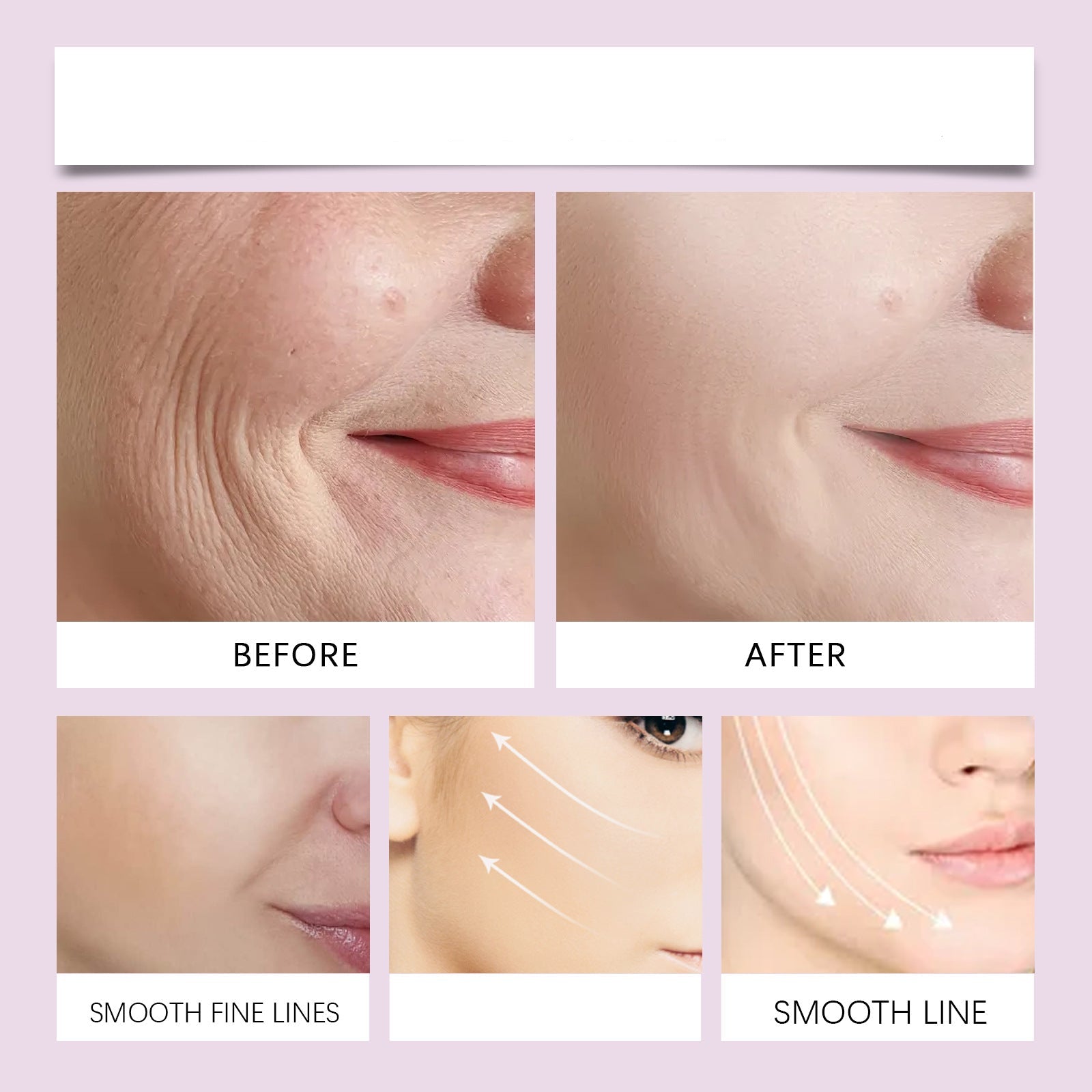 BeauLift Unsichtbares Face-Lifting Tape | Sofortiger Lifting-Effekt | 1+1 GRATIS