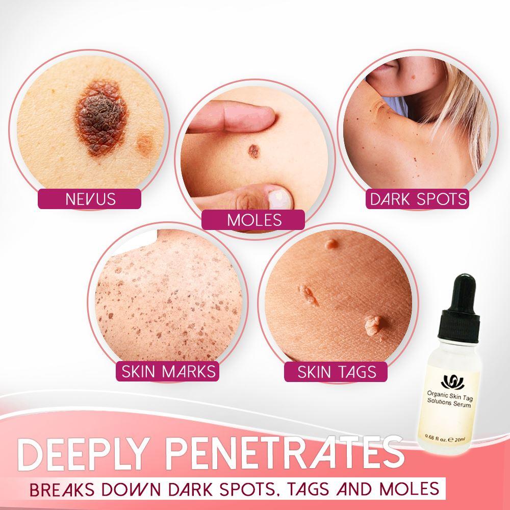 Spotless Skin Serum™- Organisches Serum zur Lösung von Hautflecken