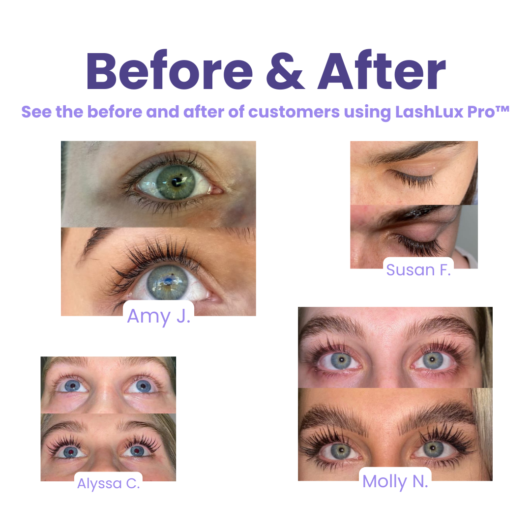 1+1 GRATIS | LashLux Pro™ - Wimpernwachstumsserum
