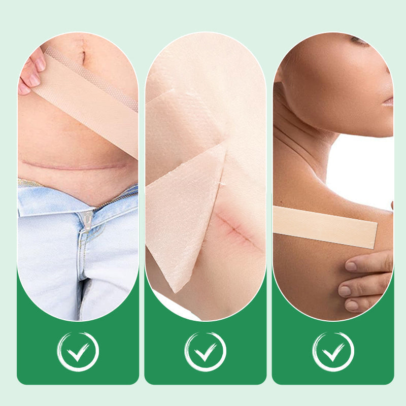 Scarify™ Silikonpflaster | Wiederverwendbar & Hautfreundlich | 1+1 Gratis