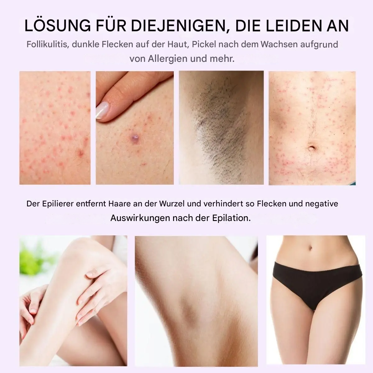 Laserremover™ - Schmerzfreie Haarentfernung