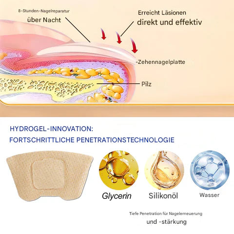 1+1 GRATIS | Nailox™ – Schnelle & diskrete Nagelpilz-Behandlung
