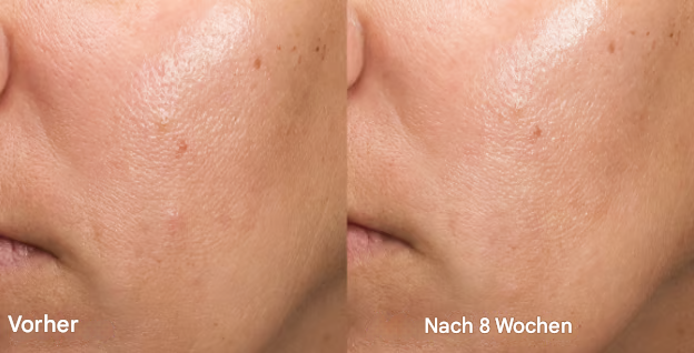 RefreshGlow™ - Sanftes Peeling, Strahlende Haut