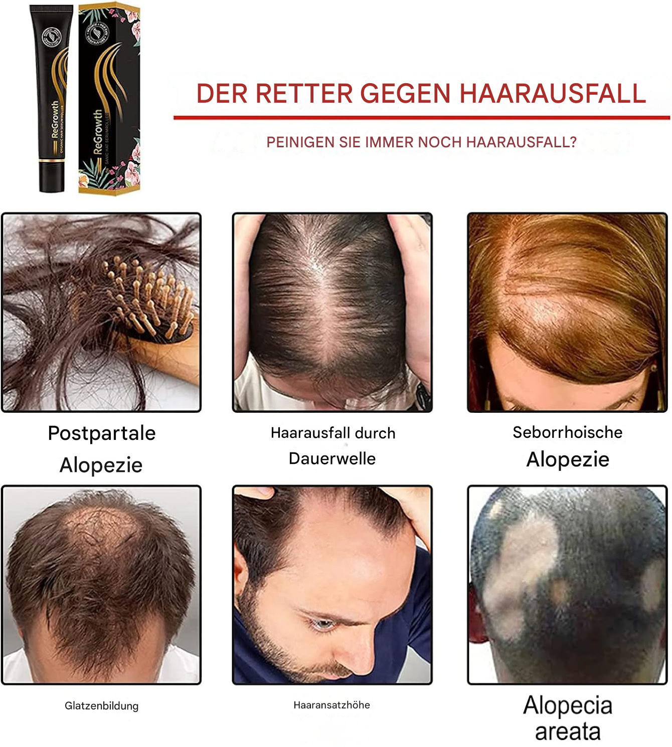 1+1 GRATIS | Follicyn™ Bio-Haarserum Roller