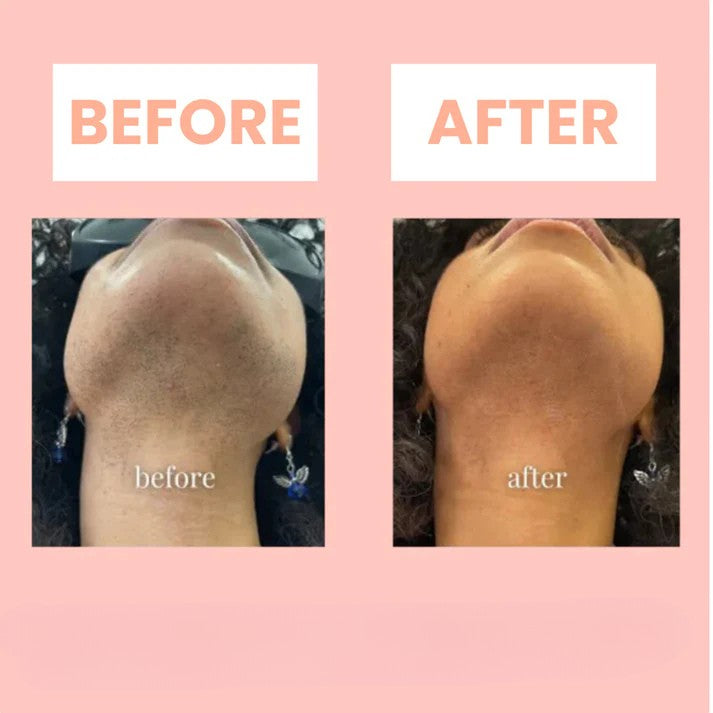 BareSmooth™ | Enthaarungscreme für Frauen