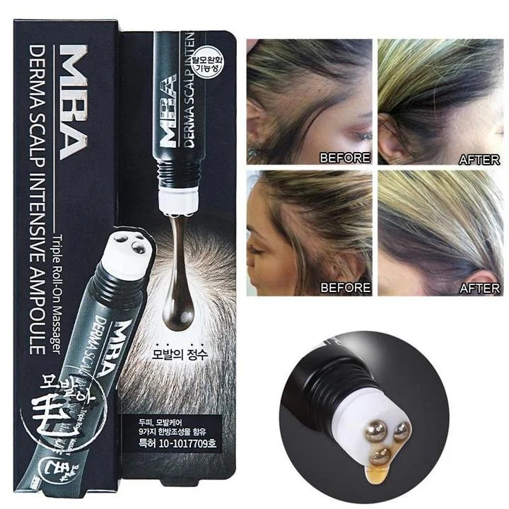 Growhair™ Haarwuchs-Serum Roll-on | 1+1 Gratis | Dichtes & Gesundes Haar