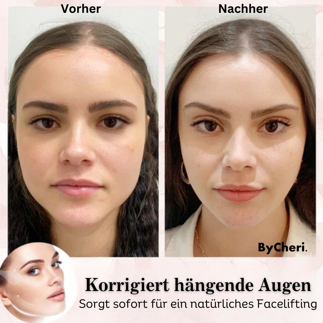 1 + 1 GRATIS HEUTE | 2025 Unsichtbares Facelifting-Band-Set™