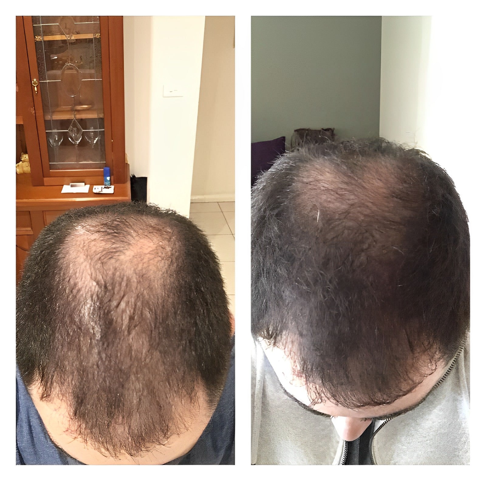 1 + 1 GRATIS HEUTE | SorcerySoap™ -Anti-Haarausfall-Reis Shampoobar