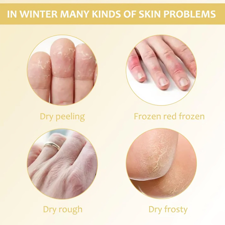 1 + 2 GRATIS HEUTE | HydraHeel™