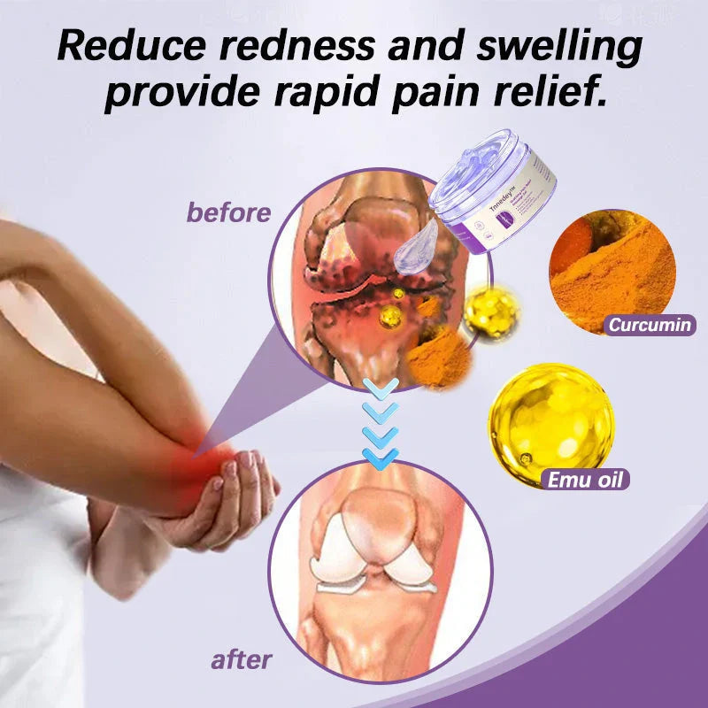 Relievium™ - Kurkuma & Emu Öl Arthritis Schmerzlinderndes Massagegel