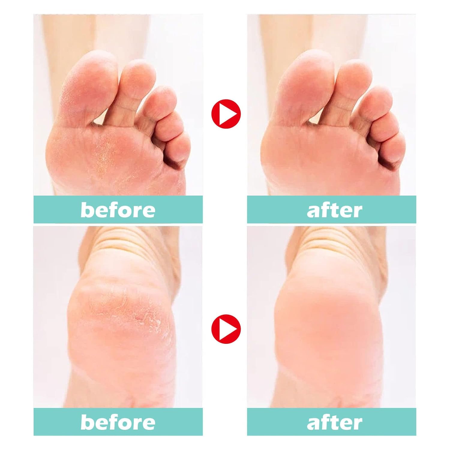 1+1 GRATIS | Medical Foot Care Cream™ — Heilt und schützt rissige Haut für langanhaltenden Komfort