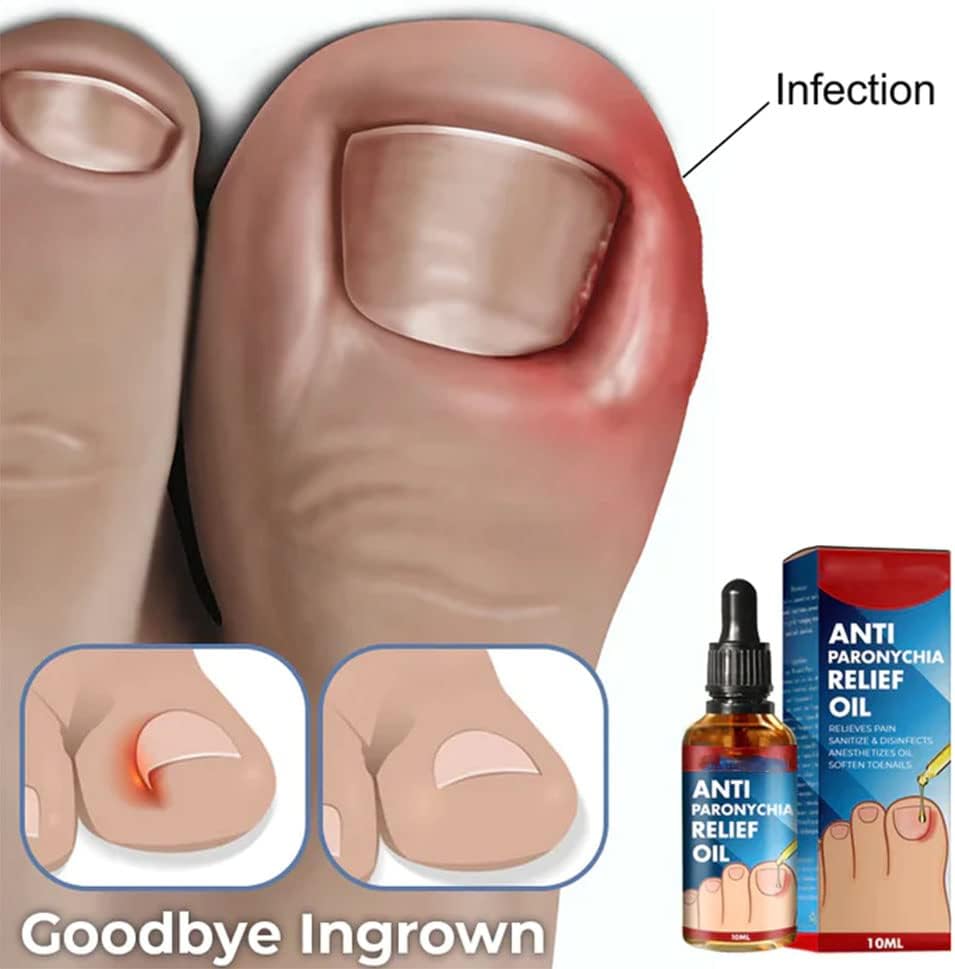 1+1 Gratis | HealNail™ Reparatur beschädigter Nägel in 4 Wochen